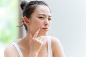 吹き出物ができやすい原因とは？繰り返す大人肌トラブルの理由を解説