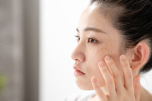 シミ取りでおすすめの方法とは？レーザーの種類・リスクとエステでできるシミ対策